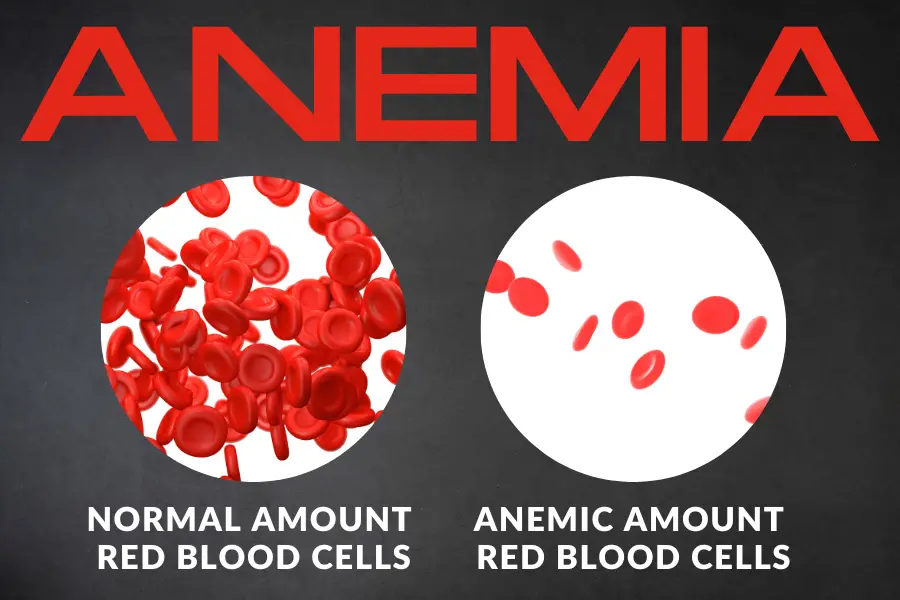 What is Anemia in Goats?